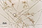 7 - Fascicolo corticale con cellula secretrice terminale